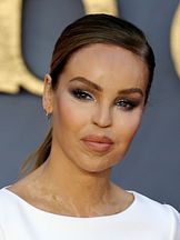 photo de Katie Piper