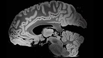 image de The Brain - Cinq nouvelles du cerveau Bande-annonce VF