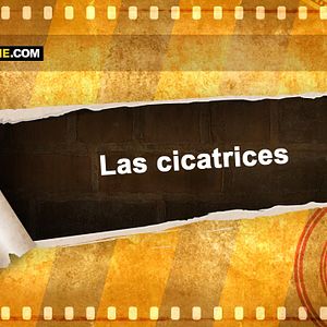 Photo Las cicatrices