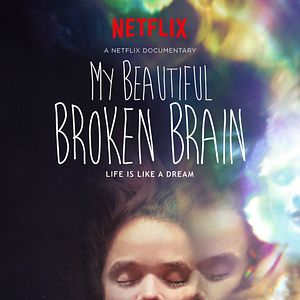 Photo My Beautiful Broken Brain