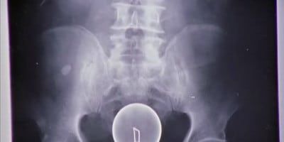 poster de la série Mes conflits