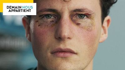 image de la news Demain nous appartient : Jack sur le point de retrouver la vue ? On a la réponse !