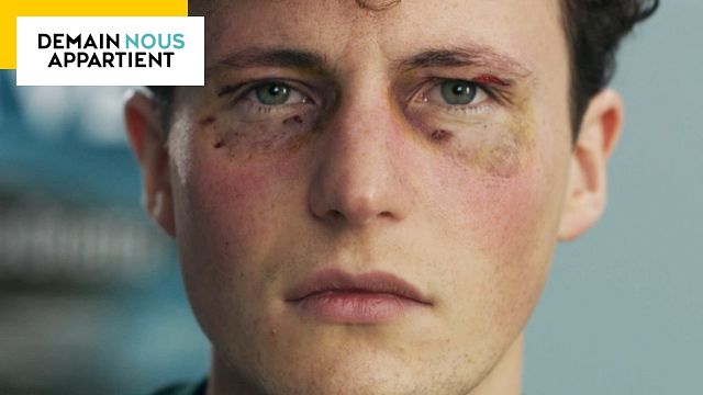 image de la news Demain nous appartient : Jack sur le point de retrouver la vue ? On a la réponse !