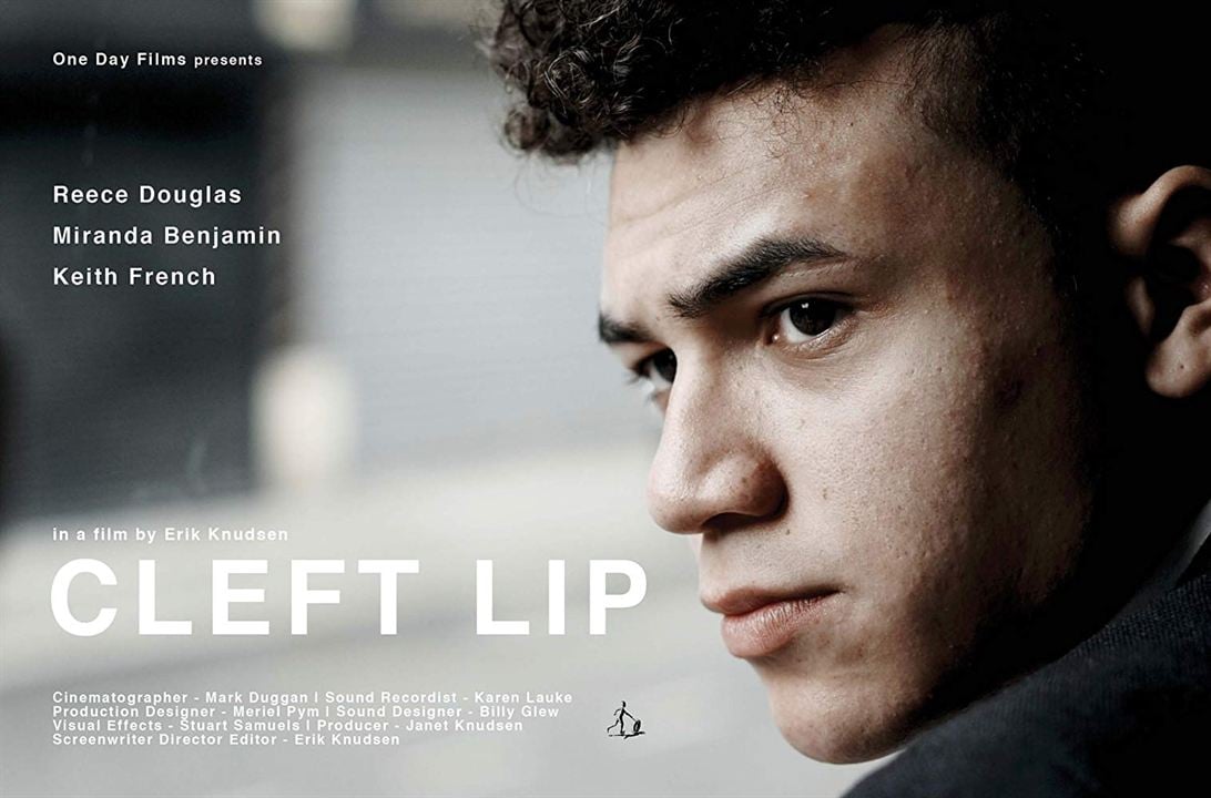 Cleft Lip : Affiche